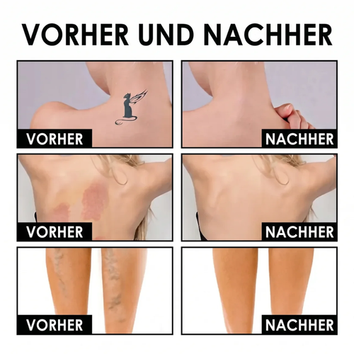 Körper-Perfektionierer