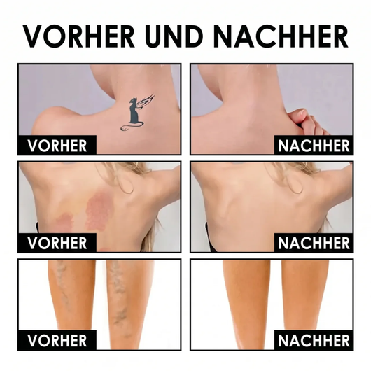 Körper-Perfektionierer